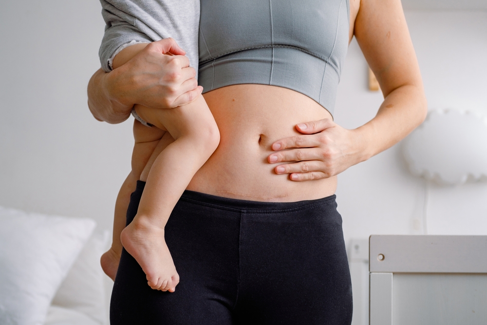 Woman holding baby after her c section.